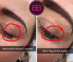 Check spelling or type a new query. Facebook