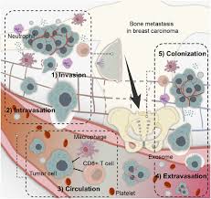 Image result for Primary Tumor Localization