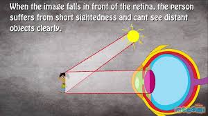 The eye is the organ of sight and is shaped as a slightly irregular hollow sphere. How Do Eyes And Ears Work Lessons Blendspace