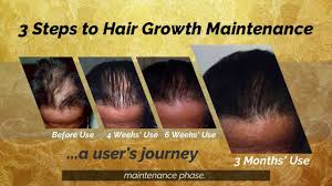 There are many reasons your hair may fall out, from genetics and vitamin deficiencies, to hormone changes. 3 Steps To Hair Growth Maintenance A User S Hair Growth Journey Youtube