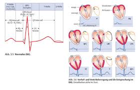 An abnormal ekg can be a sign of heart damage or disease. Ekg Kurve Vorklinik Via Medici