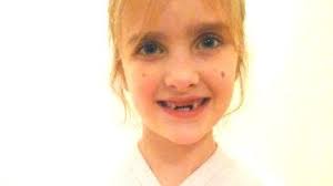 Faces of Meningitis — American Society for Meningitis Prevention