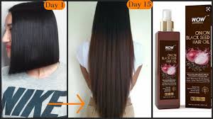 Black seed oil usege and risks. Wow Onion Black Seed Oil Promote Hair Growth 100 à¤œ à¤†à¤ªà¤• à¤¬ à¤² à¤• à¤¤ à¤œ à¤¸ à¤² à¤¬ à¤•à¤° Youtube