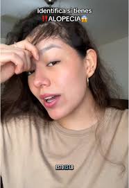 Cómo cuidar tu cabello y prevenir la alopecia