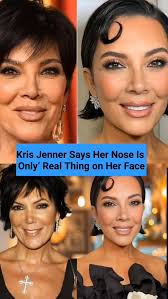 Kris Jenner turned 70 and might've just revealed her beauty secret, her  surgeon. Watch to know MO. #KrisJenner #Kardashian #Jenner #Facelift  #PlasticSurgery #ViralVideo #Viral #MO