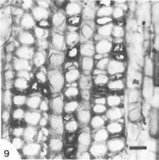Image result for Allocassine laurifolia