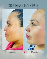 Consultorio Dental Dra. Nashiely