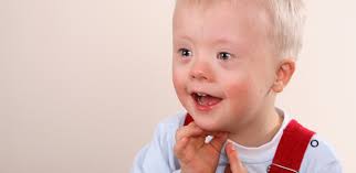 Why So Many Babies Are Still Being Born With Down Syndrome The Atlantic
