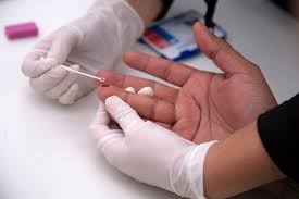 Diributkan terserang virus hiv, penyebab penyakit kulit jupiter fortissimo dibeberkan pengacaranya. Tanda Tanda Hiv 15 Tanda Tak Disedari Ramai Orang Theasianparent Malaysia