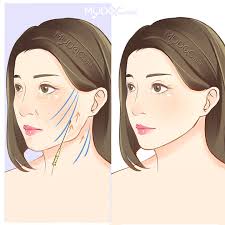 Watch me do a watson glaser test (+ tips on how to. 47 Best Thread Lift In Malaysia Price Guide Reviews
