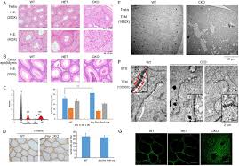 Check spelling or type a new query. Functional Importance Of Jmy Expression By Sertoli Cells In Mediating Mouse Spermatogenesis Biorxiv