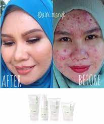 More reviews, photos and discussions for mary kay. Nur Aini Binti Azhar Best Betul Ke Pakai Set Mary Kay Botanical Effects