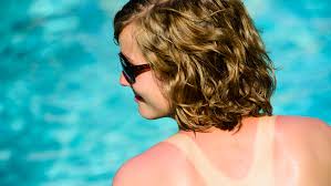 Maybe you would like to learn more about one of these? Put Out The Fire Tips For Treating Sunburn Ohio State Wexner Medical Center
