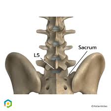 Image result for Pedistylis