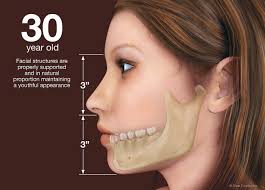 Hidden Consequences Of Losing Teeth How Dental Implants Stop Gradual Bone Loss Dental Implants Dentist Dental