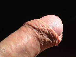 File:Erect penis of 33-year-old male.jpg - Wikipedia