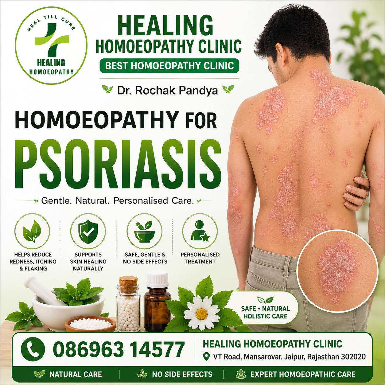 PSORIASIS
