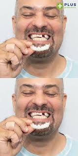 Frank Rosa (Bookie175)