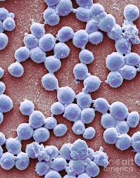 Image result for Streptococcus