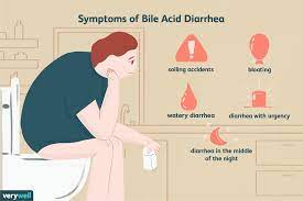 Understanding Bile Acid Diarrhea