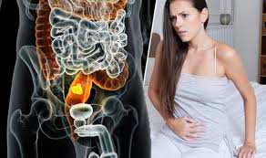 The signs or symptoms of stomach cancer include: Bowel Cancer Symptoms Stomach Pain Could Be A Sign Of Disease Express Co Uk