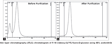 The positron emission tomography/computed tomography (pet/ct) scanner, in which pet and ct are combined. Practical Consideration Regarding Stability Of F 18 2 Deoxy 2 18f Fluoro D Glucose Procured From A Distant Commercial Production Site Semantic Scholar