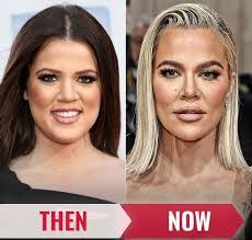 Carl Molnar's Instagram, Twitter & Facebook