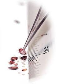 We did not find results for: 27 Bed Bugs Ideas Bed Bugs Bugs Pest Control