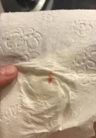 Den gesamten vorgang vom einbetten bis zum vollständigen eingraben bezeichnet man als einnistung. Einnistungsblutung Forum Kinderwunsch Urbia De