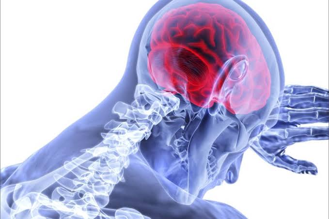 حتى رضة خفيفة للرأس قد تسبب عجزا دائما | أخبار صحة | الجزيرة نت