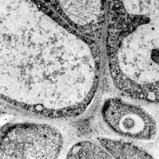 Under a microscope, plant cells are surrounded by cell wall, which are not present in animal cells. Electron Micrograph Of Cell Walls In The Cell Vacuolization Region Just Download Scientific Diagram