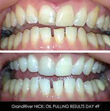 The oils used for oil pulling vary widely. Adventures In Oil Pulling My 21 Day Experiment Rio Rocket Actor Artist Entrepreneur