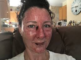 Real-life 'mermaid' who lay