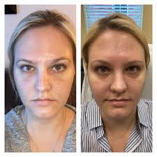 TOP 10 BEST Electrolysis near Agra, OK