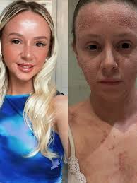 Anyone know of any mobile dog groomers or vet nurse etc who can come cut my  dogs nails in west end, im literally at my wits end wirh them,I've taken  him to