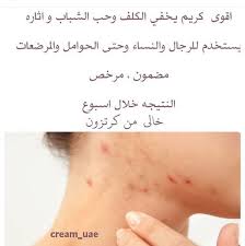 ضيفوها عندنا اقوى كريم للجسم يشيل التشققات وعلامات التمدد الناتجه عن الحمل وكريم للوجه للتبيض وازالة الحبوب والتصبغات مرخص مضمون C Tattoo Quotes Quotes Math
