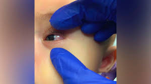 Home life health & family vital: Mis C Cdc Warns Doctors About Childhood Inflammatory Syndrome Linked To Covid 19 Cnn