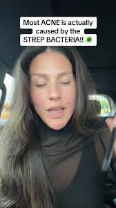 Medical Medium Anthony William Deutsch Rosacea