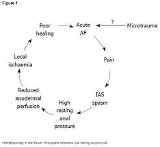 Anal Fissures Handout Time Of Care