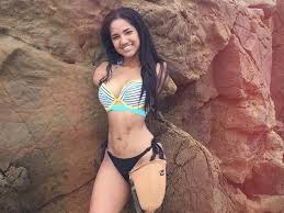 Im a triple amputee and hot model – I love inspiring people with my story  - Daily Star