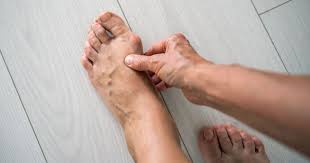 Image result for Hallux Varus