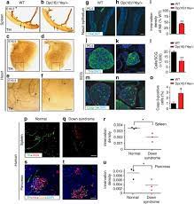 Rcan1 Links Impaired Neurotrophin Trafficking To Aberrant Development Of The Sympathetic Nervous System In Down Syndrome Nature Communications