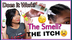 Still in a working progress, very happy i found something that works quickly. I Used Wild Growth Oil For One Month Is It Worth It Q A Youtube