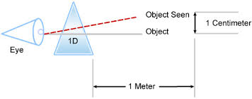 20 20 Vision How To Convert 20 20 Based Measure To Diopters