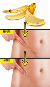 10 Unusual Ways To Use Banana Peels I wish i would have found it sooner. 10 unusual ways to use banana peels