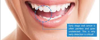In the early stages, mouth cancer rarely causes any pain. See How Your Oral Cancer Exam Will Go In Flagstaff Az