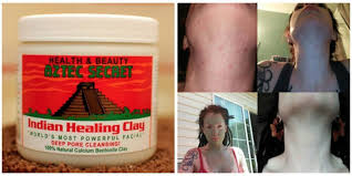This Skincare Product Is Going Viral For The Best Reason Clay Mask Benefits Indian Healing Clay Mask Aztec Clay
