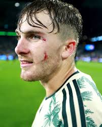 世界以痛吻我，我要報之以歌。」 印度詩人泰戈爾活着真的不容易活得好實在需要很大勇氣、堅毅與決心；  每次跌倒，只能自己爬起來，拍拍自己身上的塵埃，然後繼續前進。 也許生活會一直不容易