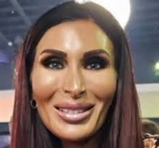 MAGA plastic face syndrome