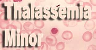 Thalassemia Minor